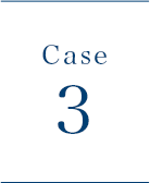 CASE3